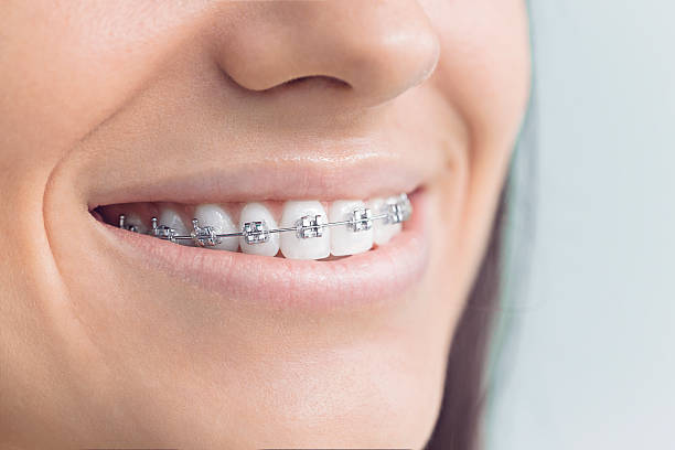 Best Teeth Whitening  in Fox Chapel, PA